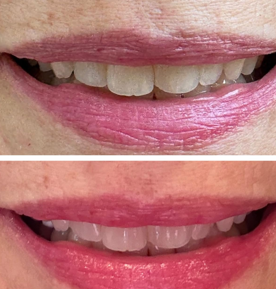 Before and after applying Coellyo Ph adjusting lipstick